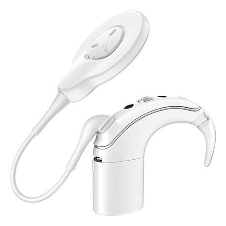 latest cochlear implant technology UAE
